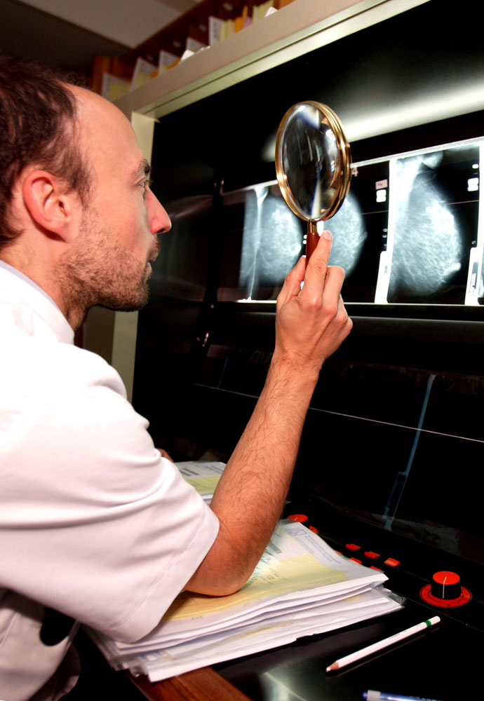 Een radioloog beoordeelt analoge borstfoto’s