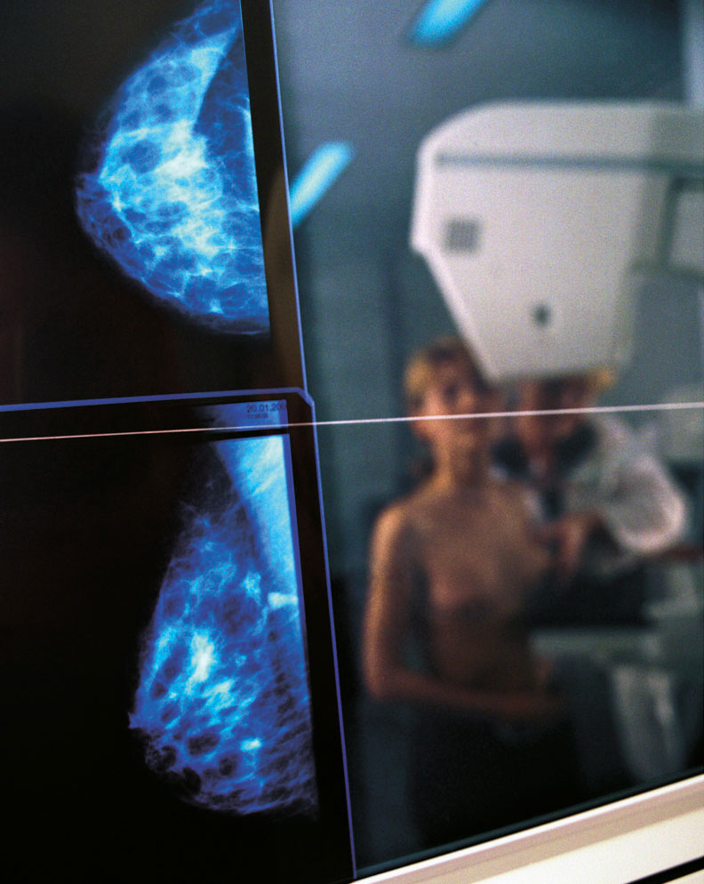 Een vrouw ondergaat een borstonderzoek. De digitale foto’s verschijnen op een beeldscherm.