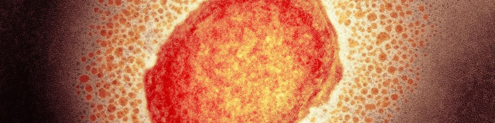 Monkeypox virus - Apenpokkenvirus