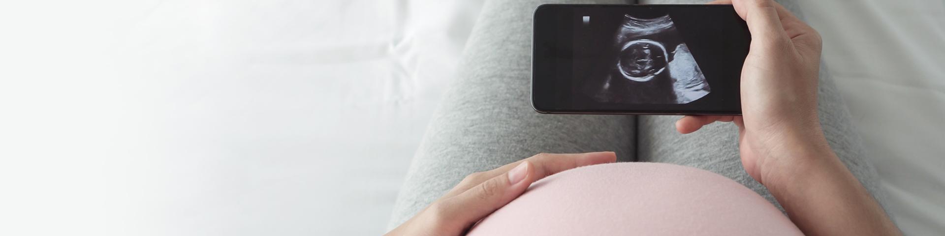 Banner Monitoren zwangerschap en geboorte