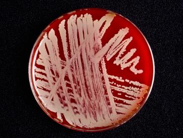 bacteriën in petri schaaltje