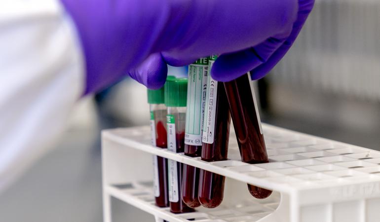 Verschillende commerciële laboratoria gebruiken zogeheten cellulaire testen voor Lyme. Helaas zijn niet betrouwbaar.