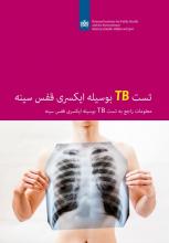 kaft brochure DAR Chest X-ray to test for TB