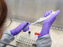 Onderzoeker in lab met pipet