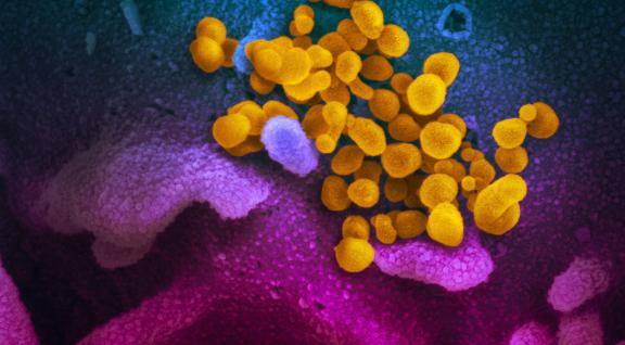 Coronavirus in kleur