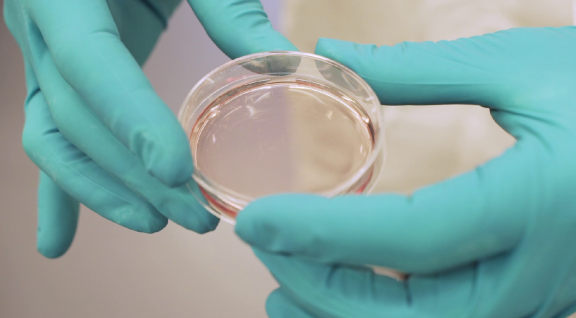 laborant bekijkt een petrischaaltje