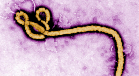 Ebolavirus