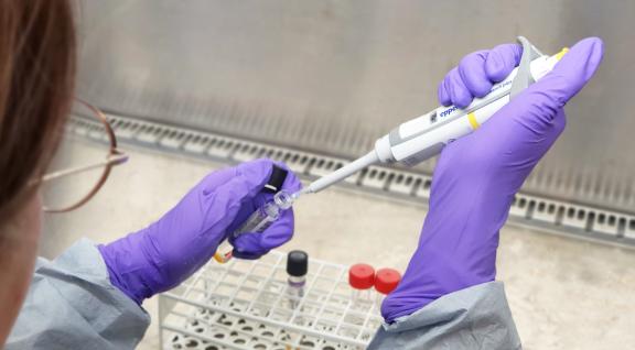 Onderzoeker in lab met pipet